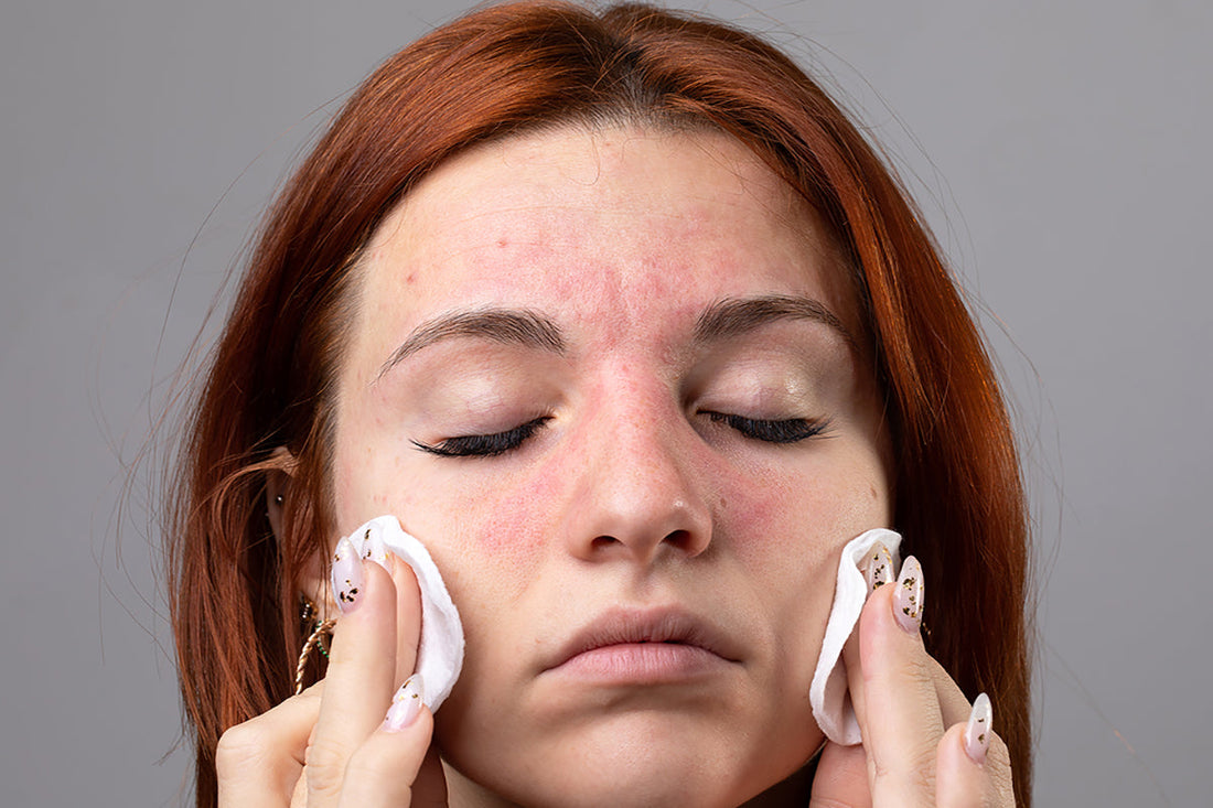 Skin Aging faster