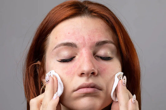 Skin Aging faster